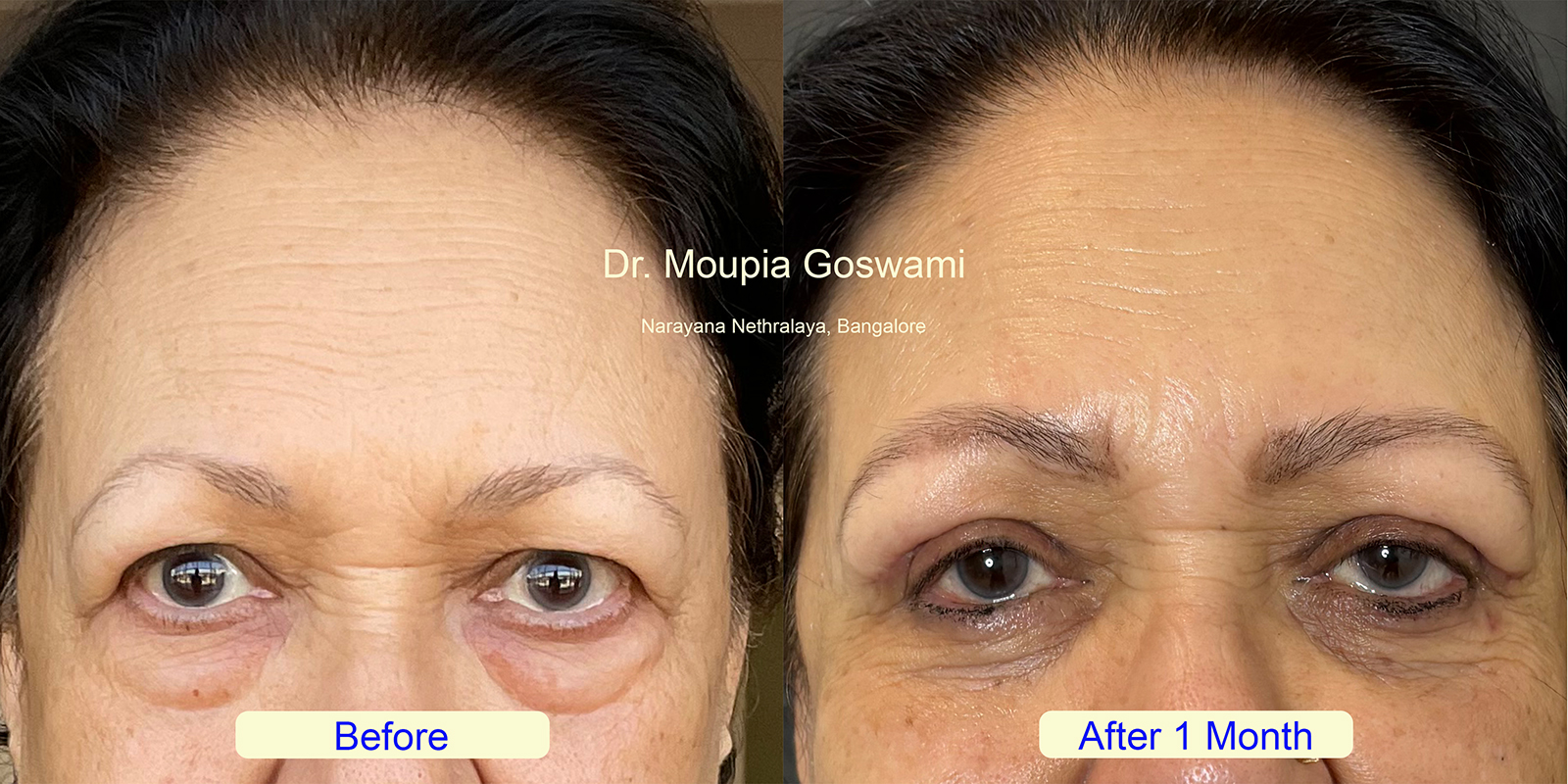 Before and After Comparison