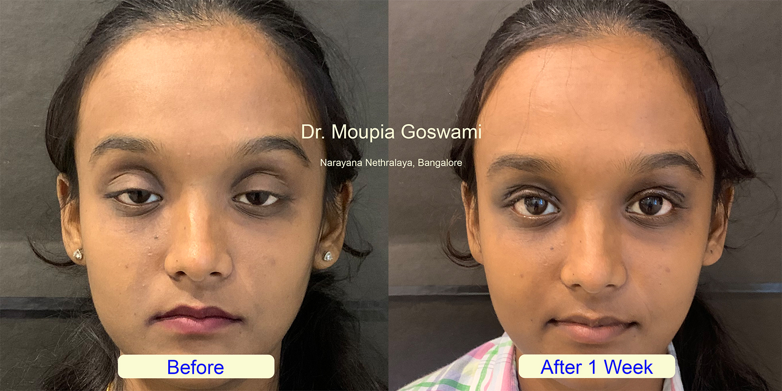 Before and After Comparison