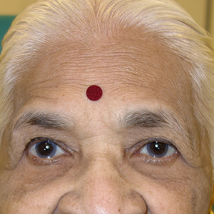 Photo 1 of a lady with Asian Eyelid or Monolid