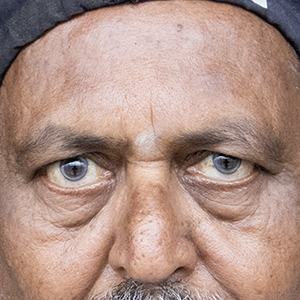 Photo 5 of a lady with Asian Eyelid or Monolid