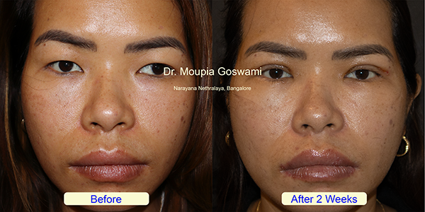 Before and After Image