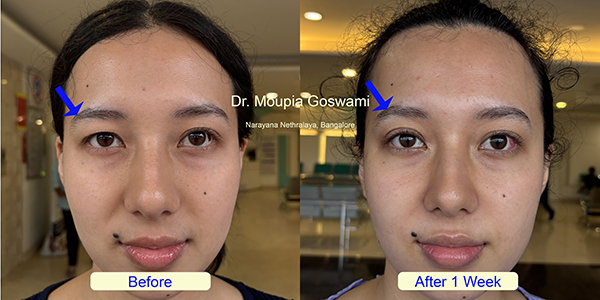 Before and After Image