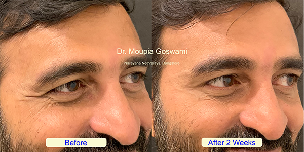 Before and After Image