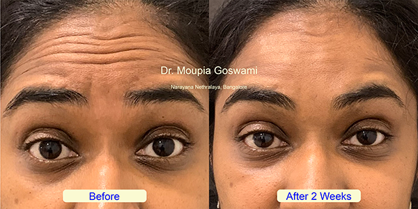 Before and After Image