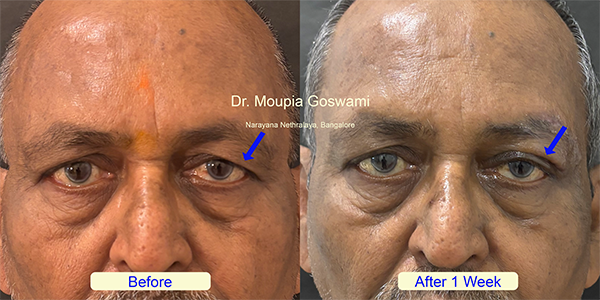 Before and After Image