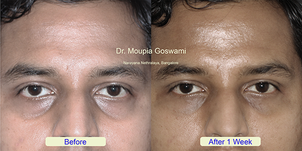 Before and After Image