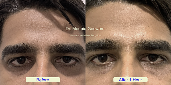 Before and After Image