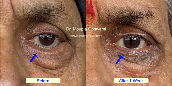 Before and After Image