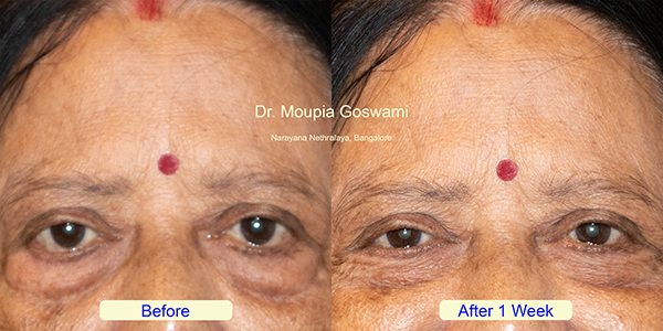 Before and After Image