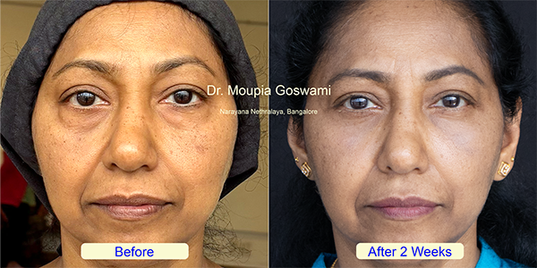 Before and After Image