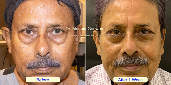 Before and After Image