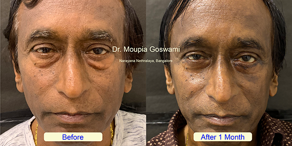 Before and After Image