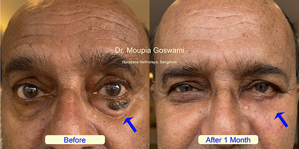 Before and After Image