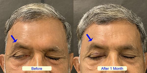 Before and After Image