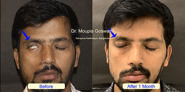 Before and After Image