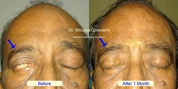 Before and After Image