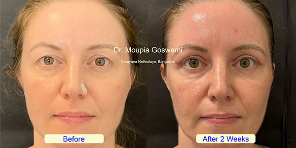 Before and After Image