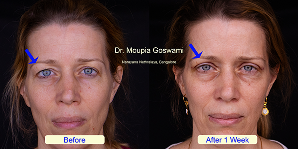 Before and After Image