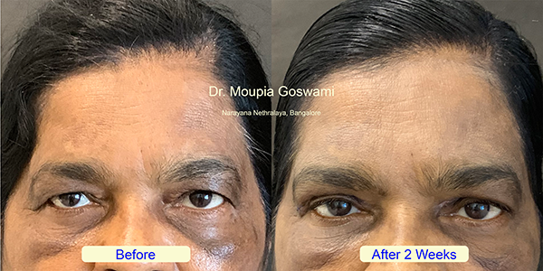 Before and After Image