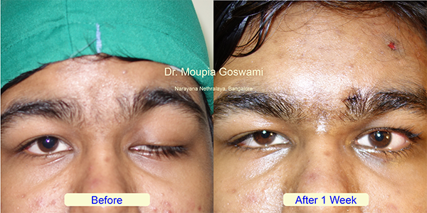 Before and After Image