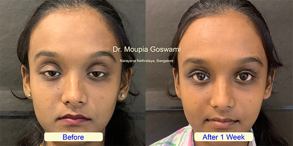 Before and After Image