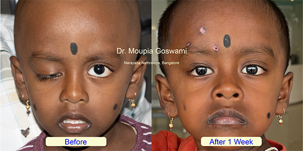 Before and After Image