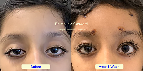 Before and After Image