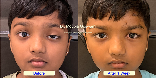 Before and After Image