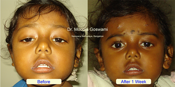 Before and After Image