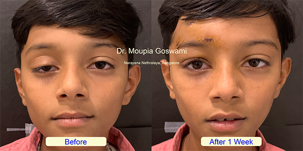 Before and After Image