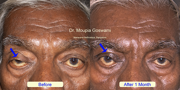 Before and After Image