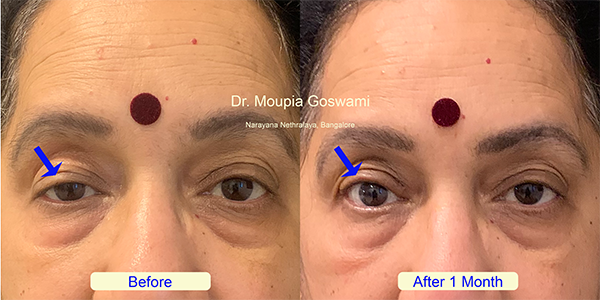 Before and After Image