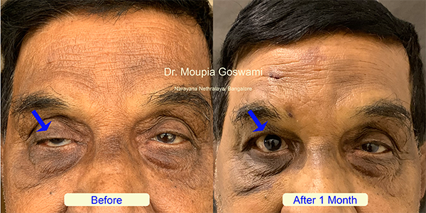 Before and After Image